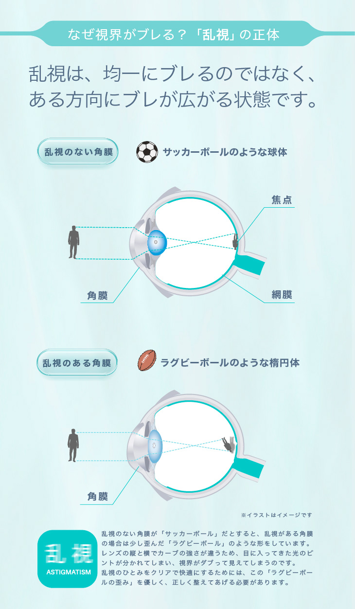 なぜ視界がブレる?「乱視」の正体 乱視は、均一にブレるのではなく、ある方向にブレが広がる状態です。|30枚 エアレンズトーリック1dayモイスチャー55% UV クリア(CYL-0.75/CYL-1.25/CYL-1.75/AXIS180°) DIA:14.5mm ワンデー コンタクトレンズ