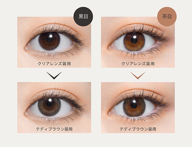 テディブラウン装用比較画像